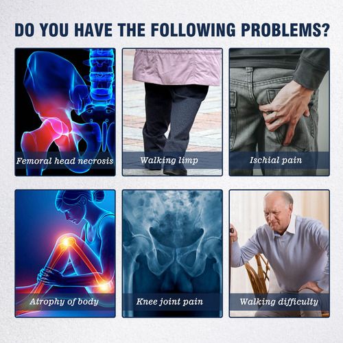 PARCHE PARA LA CIÁTICA