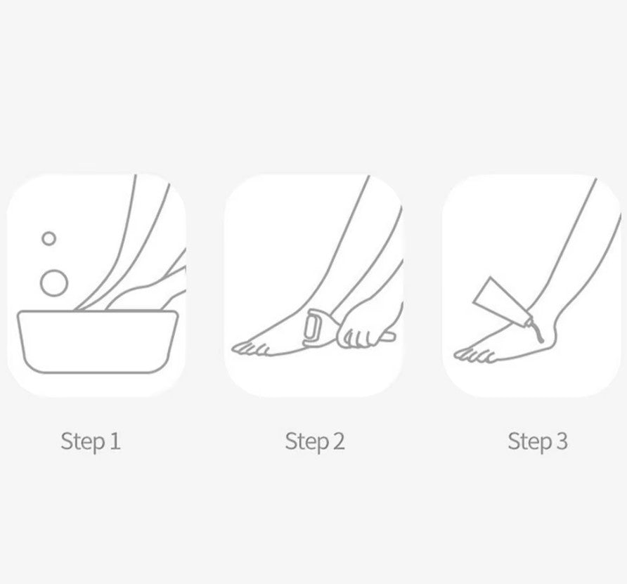 Removedor, lima de callos eléctrico