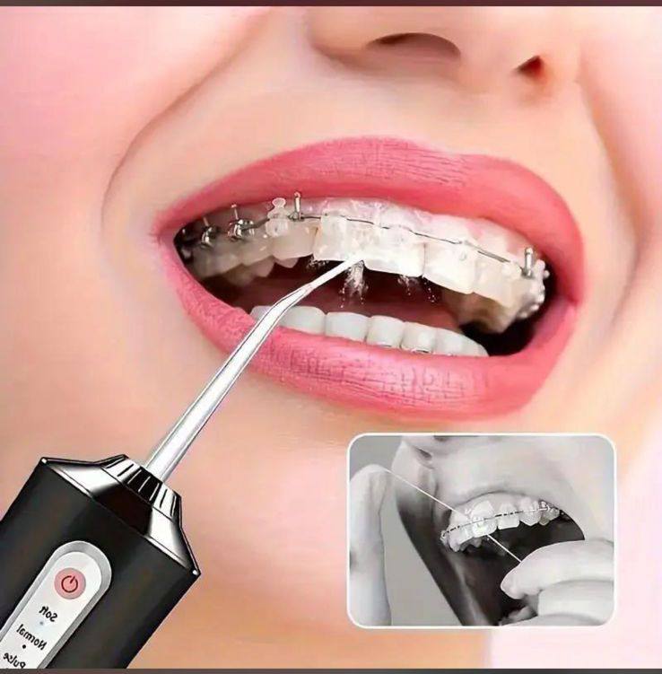Irrigador Bucal Oral Recargable para Cuidado Dental