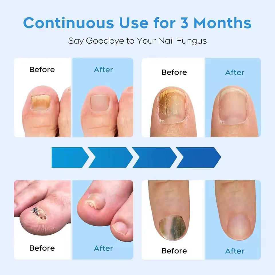 LAMPARA LED ELIMINADOR DE HONGOS